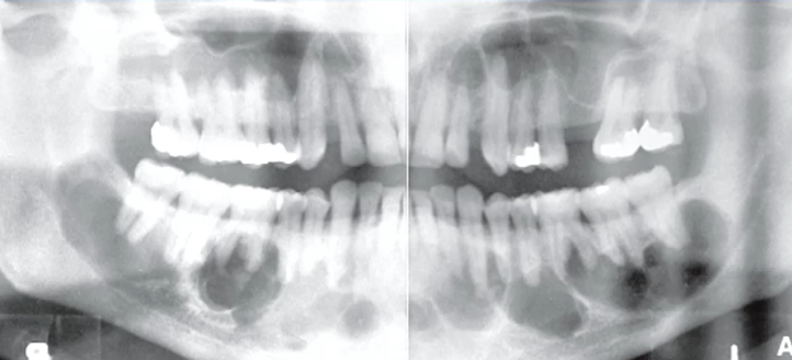 <p>most likely diagnosis </p>