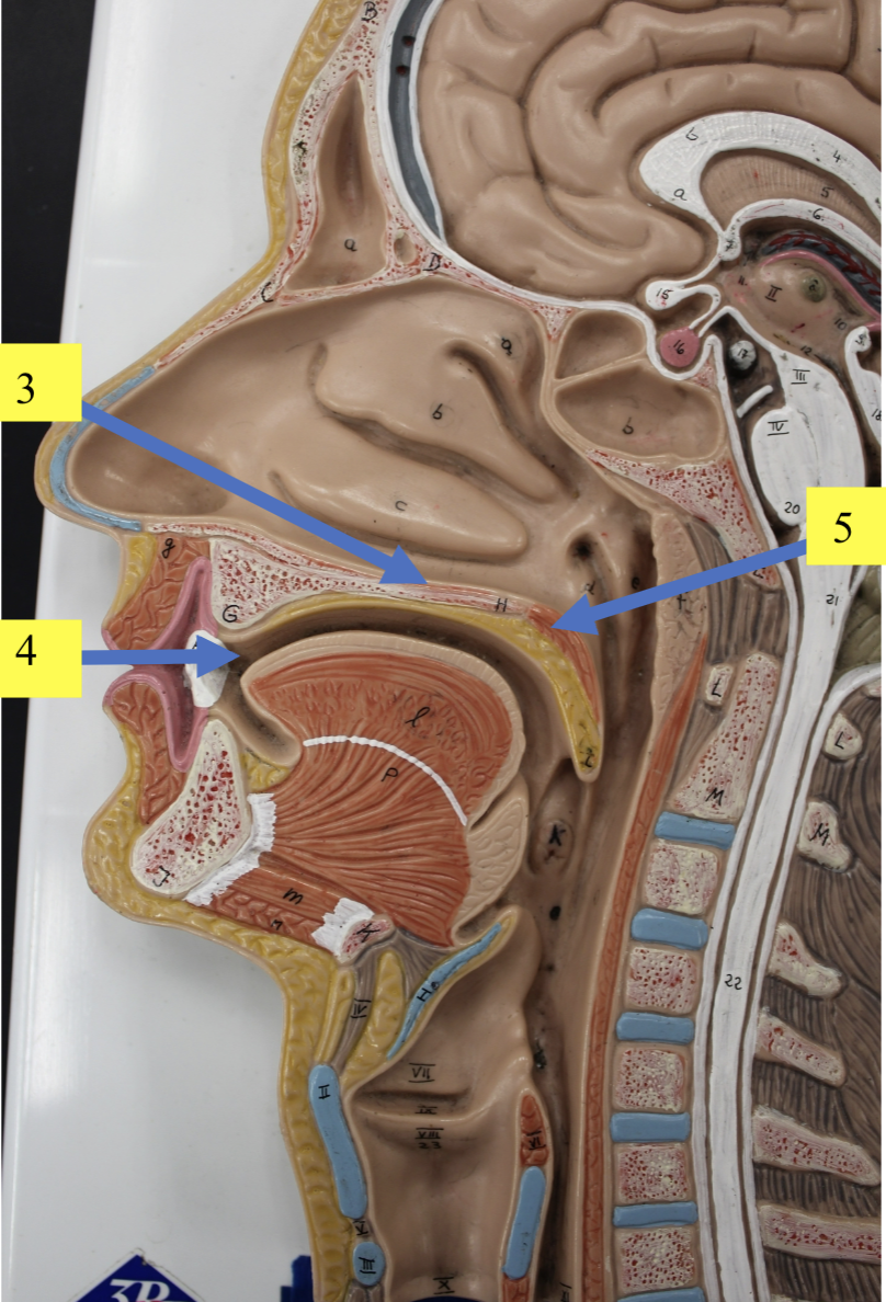 <p>structure 4 </p>