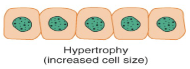 <p>Hypertrophy is cellular adaption where there is an _____ in _____ of cell due to _____ work demands or _____  _____.</p>