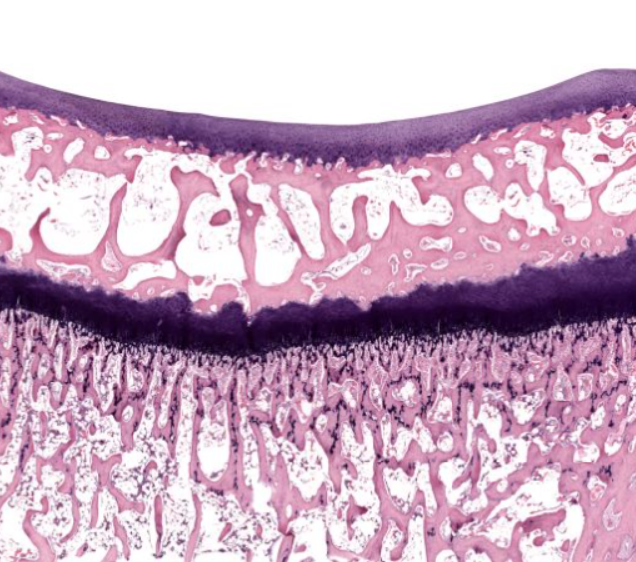 <p>the lighter purple- on the “edge” of a bone</p><p>notice the lack of a perichondrium</p>