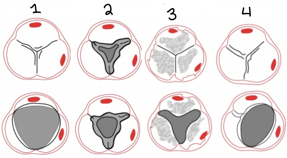 <p>Label the different AV appearances</p>