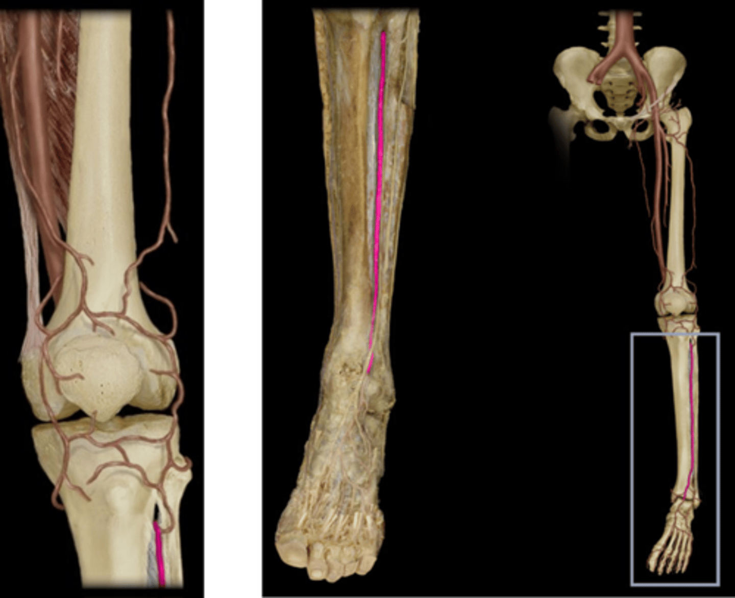 <p>Name this vessel.</p>