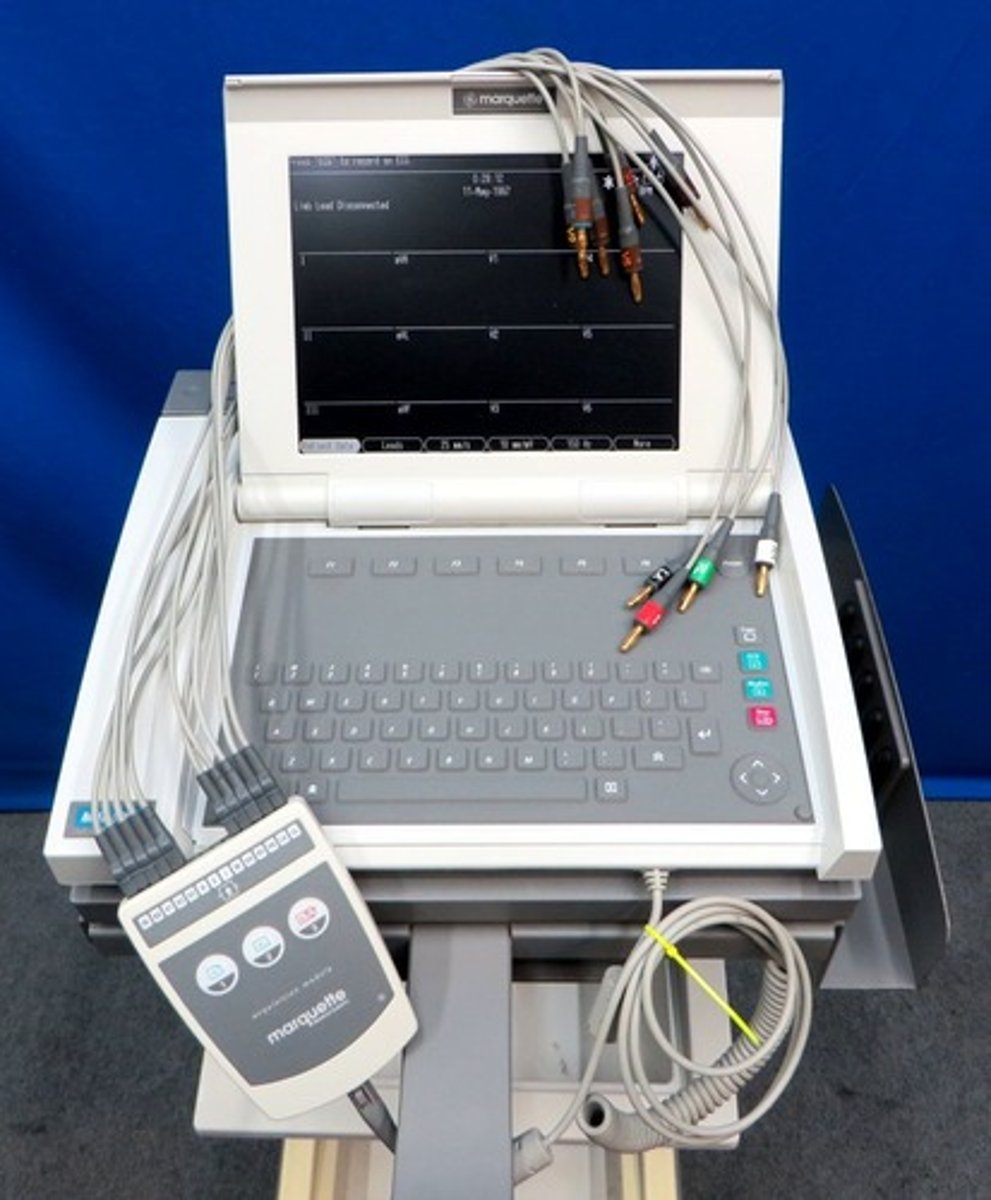 <p>Instrument that gives the ♡'s electrical activity a graphic rep</p>