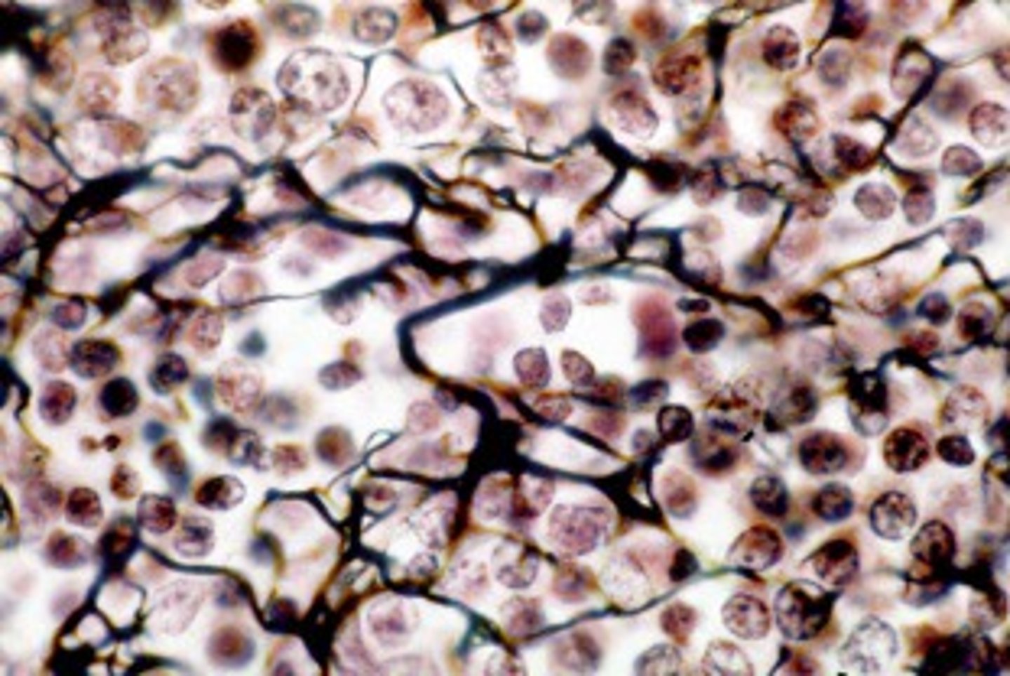 <p>Loose fibers of reticular fibers.</p>