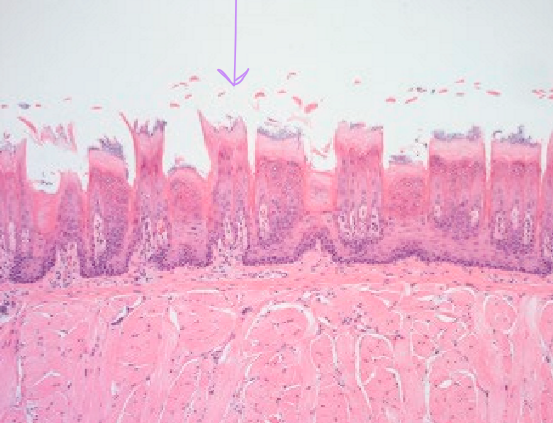 <p>What type of papilla is this?</p>