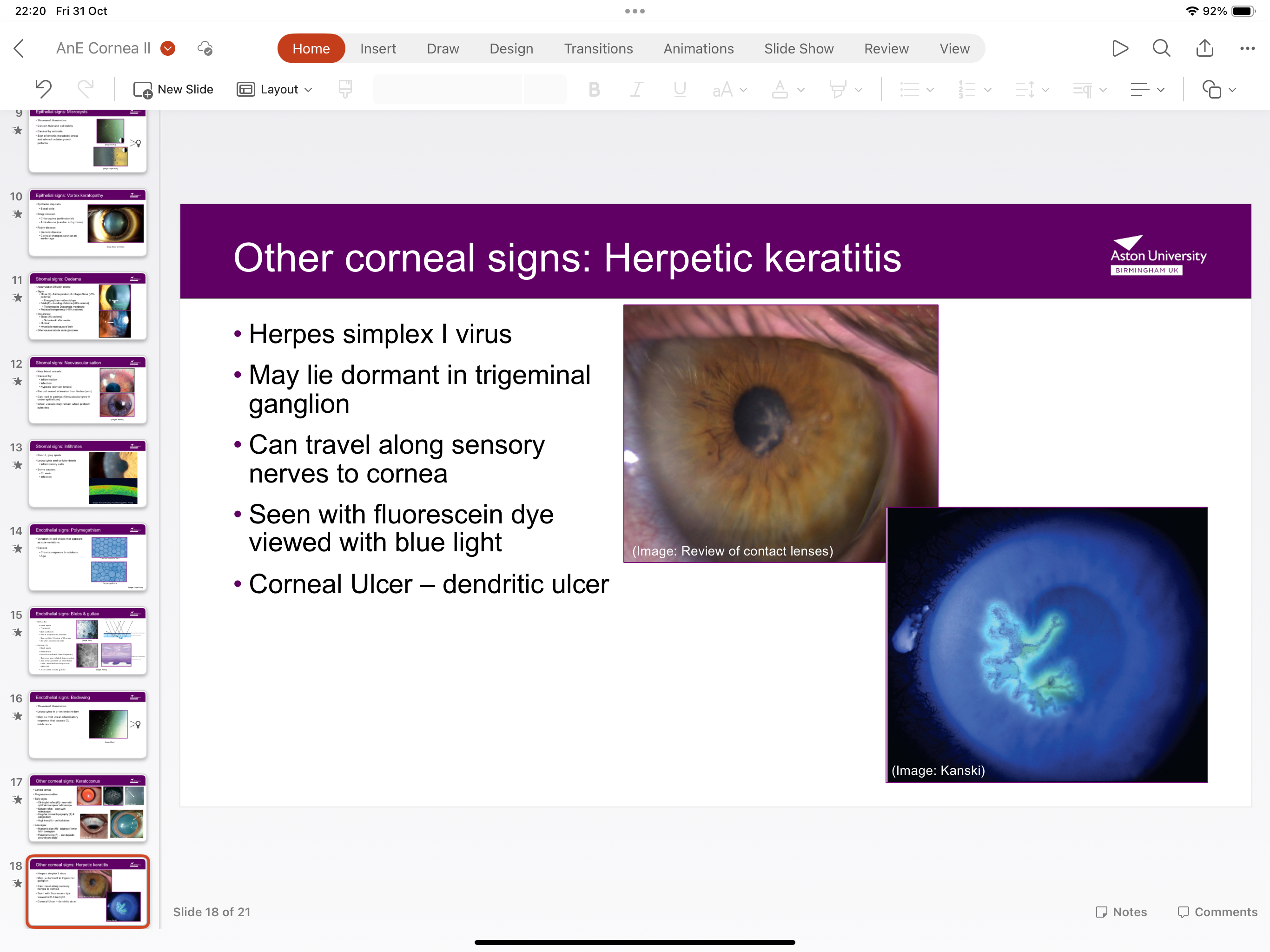 <p>Herpes simplex I virus, seen with fleurescin dye under blue light can travel along sensor nerve to cornea and lies dormant in trigeminal ganglion</p>