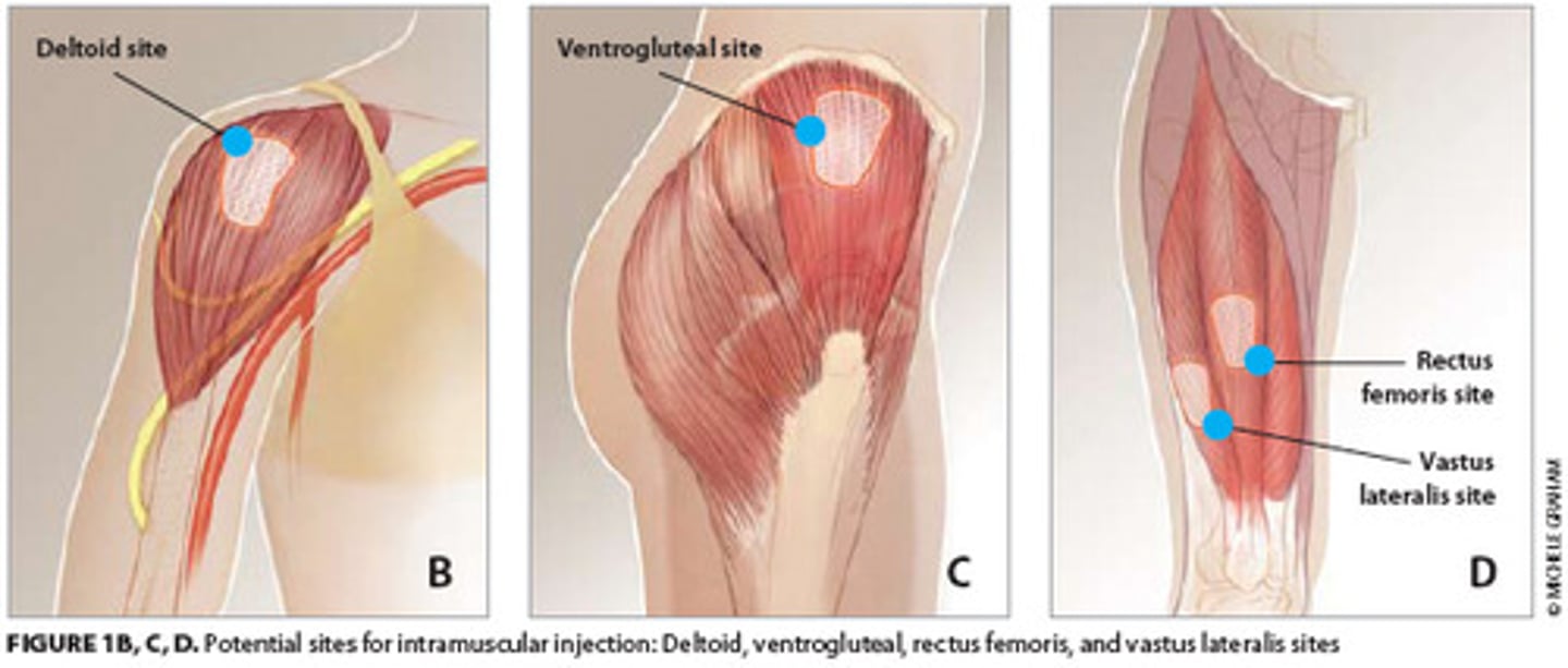<p>inject at:</p><p>- Deltoid site</p><p>- Ventrogluteal site</p><p>- Rectus femoris site</p><p>- Vastus lateralis site</p><p>*Dorsolateral (NOT recommended)</p>