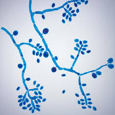 <p>Identify this fungi</p>