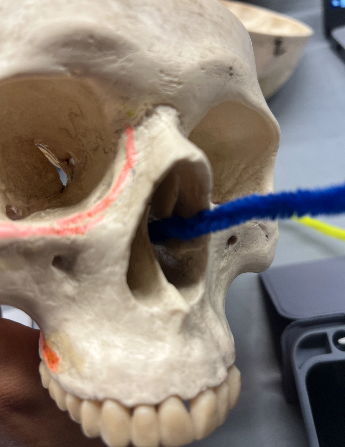 <p>What foramina is labeled by the blue pipe? What bones are the located? Also, which if any cranial nerves pass through there?</p>