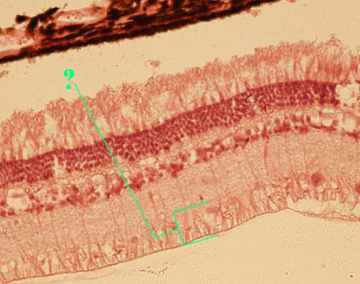 <p><span><span>Identify the indicated layer of the retina.</span></span></p>