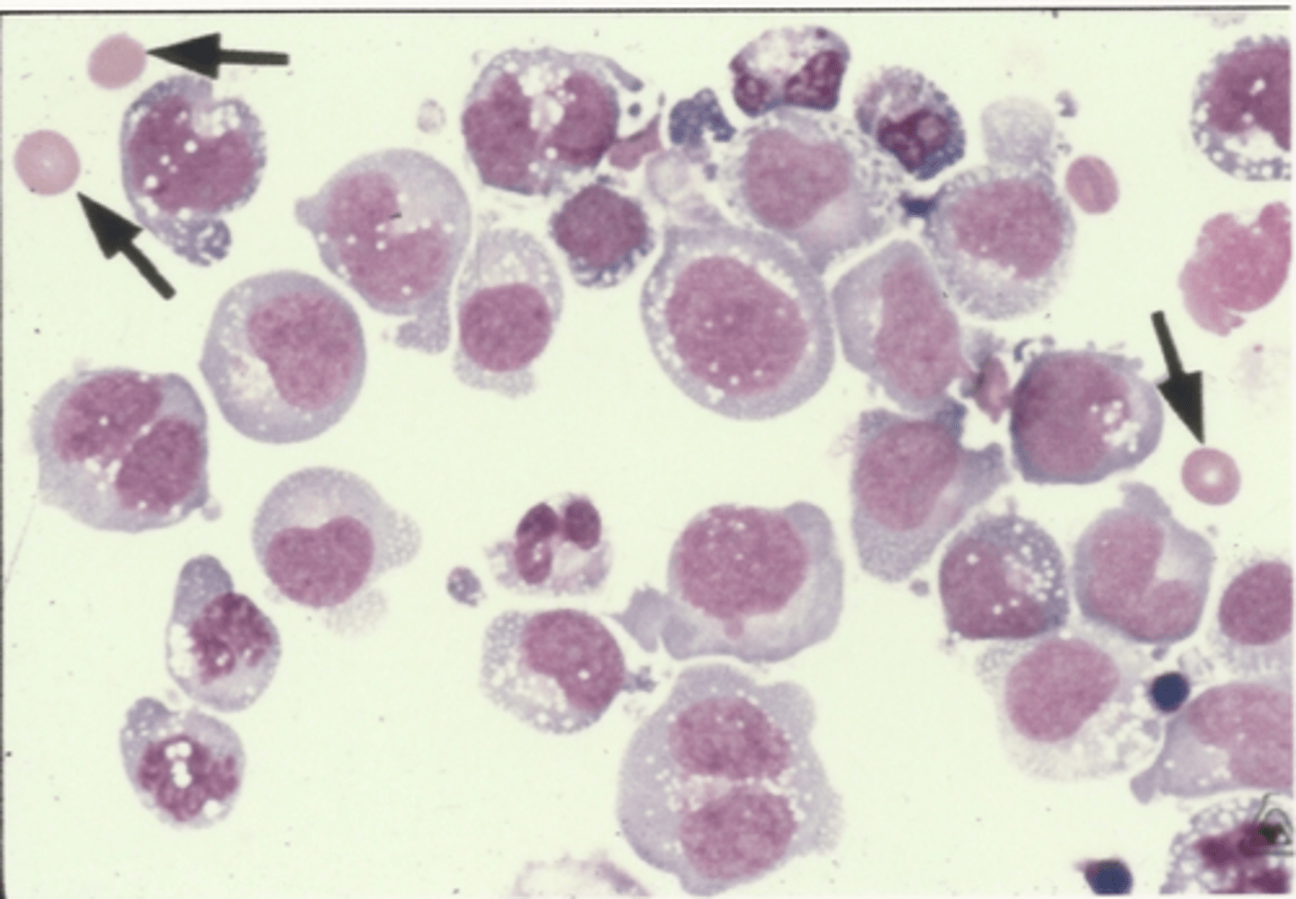 <p>Identify the cells in this body fluid</p>