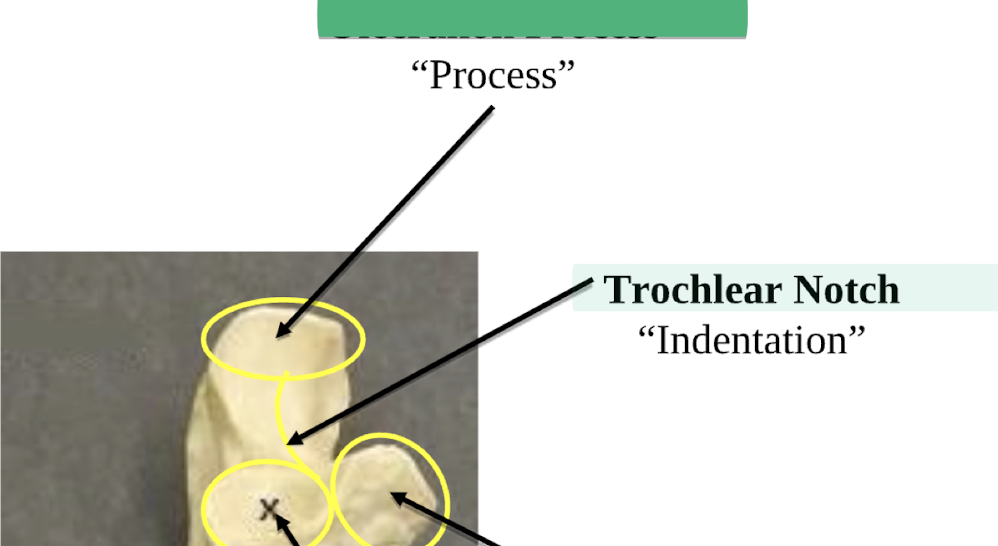 <p>Trochlear Notch </p>