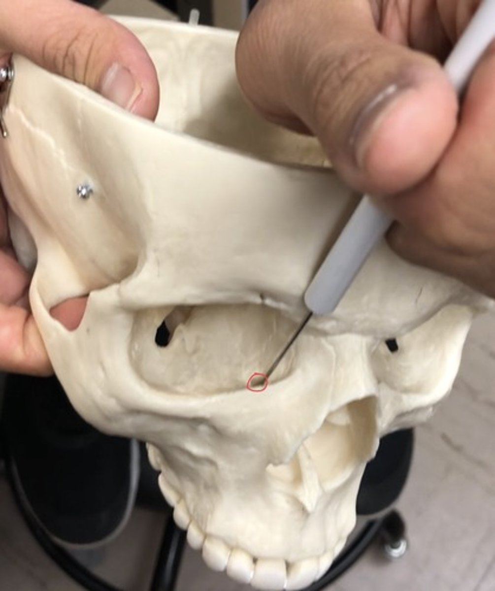 <p>Runs through the eye socket to the nose; more infront</p>