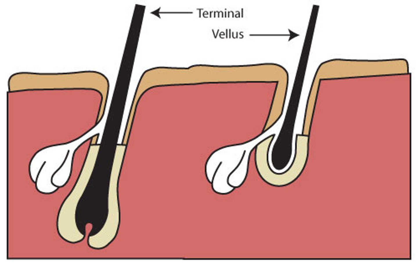 <p>Long, coarse, pigmented hair found on the scalp, legs, arms, and bodies of males and females.</p>