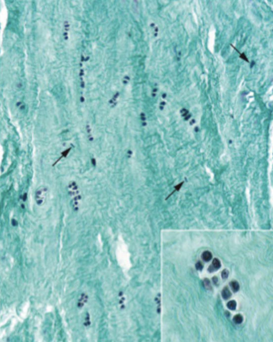 <ul><li><p>rounded nuclei with a small amount of surrounding amorphous matrix, embedded in lacunae</p></li><li><p>flattened or elongated nuclei within fibrous areas</p></li></ul><p></p>