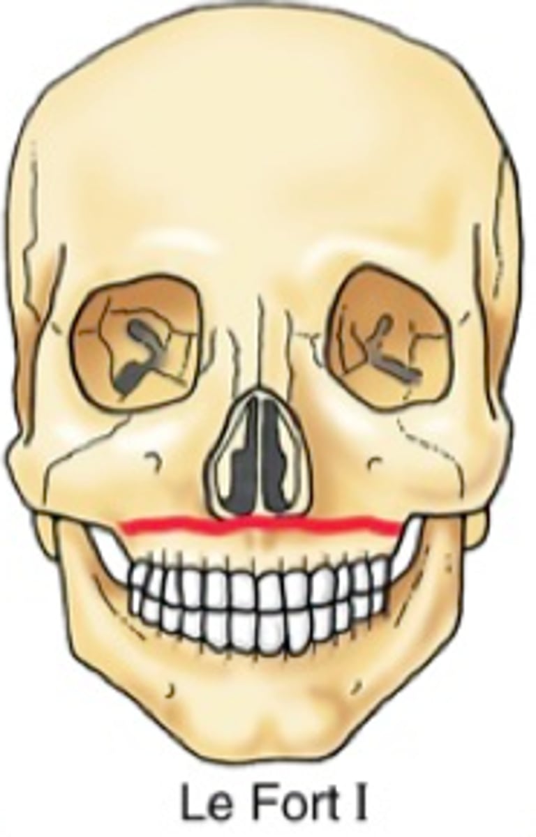 <p>1 → speak no evil</p>