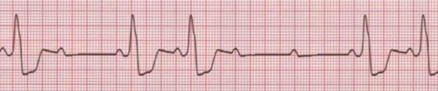 <p>Name the rhythm</p>