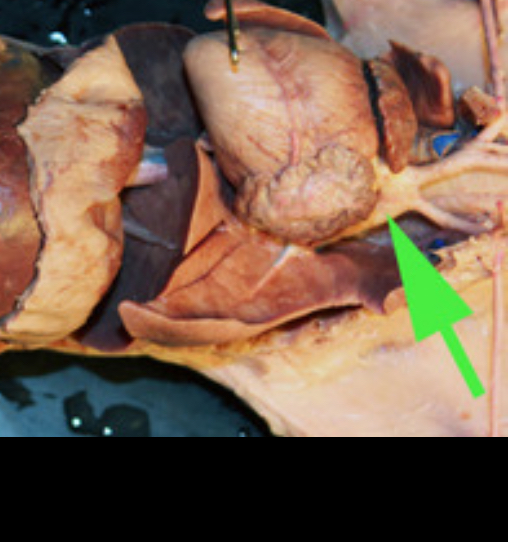<p><span>The artery marked by the green arrow is the <strong>AORTA</strong> artery.</span></p>