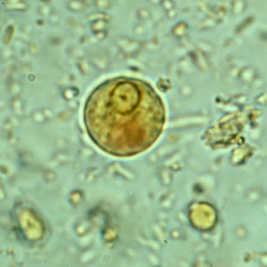 <p>Entamoeba dispar (commensal)</p>