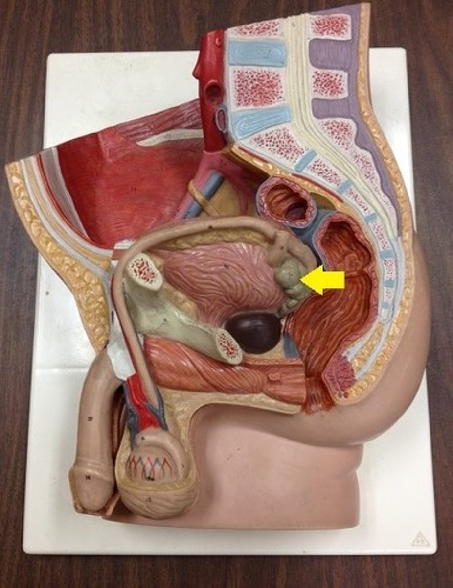 <p>Identify the gland.</p>