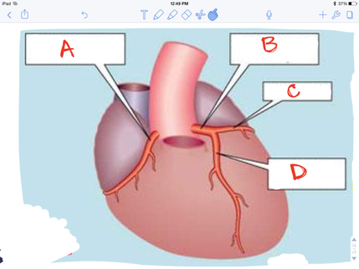 <p>Name the Artery (C)</p>