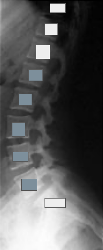 <p>What structures are referenced by the grey boxes?</p>