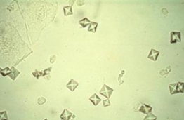 <p>What Crystal Is This? </p>