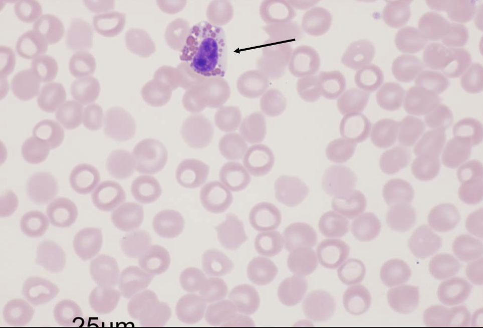 <p><span style="font-family: Lato Extended, Lato, Helvetica Neue, Helvetica, Arial, sans-serif">The cell indicated by the black arrow below has characteristics that represent something</span></p>