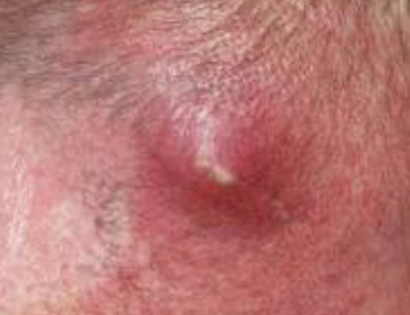 <p>What is the diagnosis?</p>