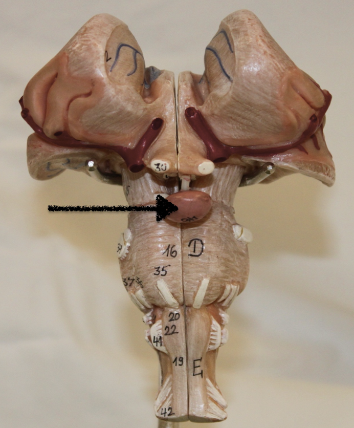 <p>identify this structue</p>