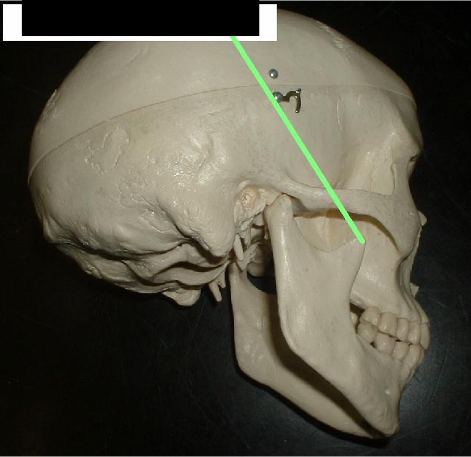<p>where the jaw moves up and down (with assistance from muscles)</p>