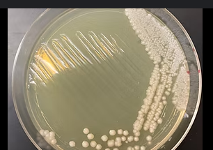 <p>small, visible clusters of cells that are often creamy-white to pinkish in color, with a smooth, moist, or slightly rough surface texture</p>