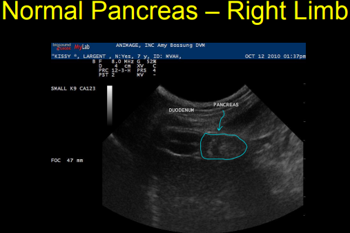 <p>Normal Pancreas on Ultrasound</p>