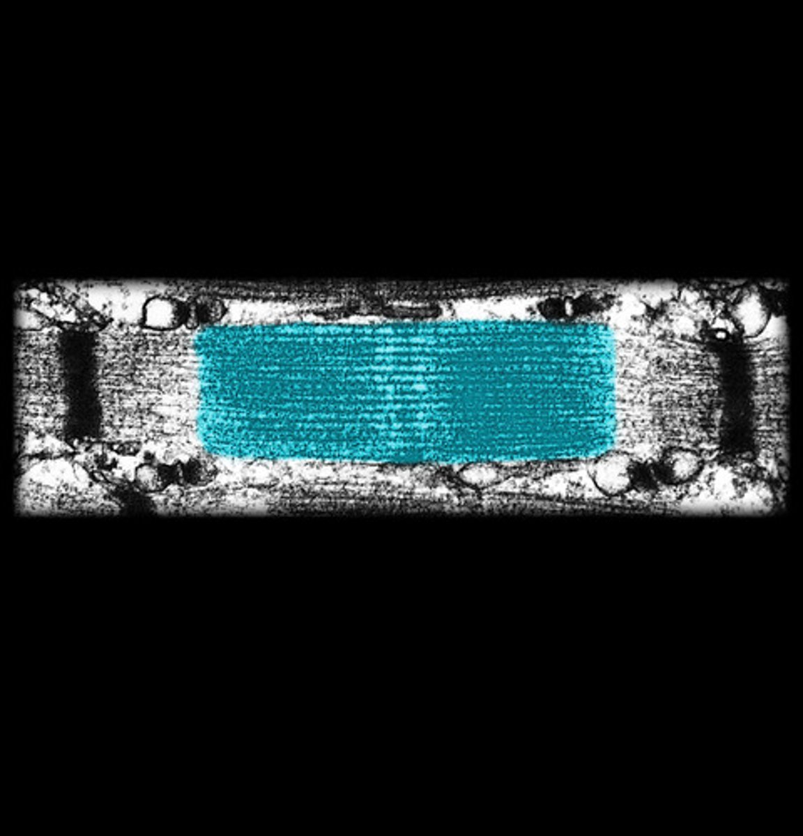 <p>area of contraction and relaxation</p>