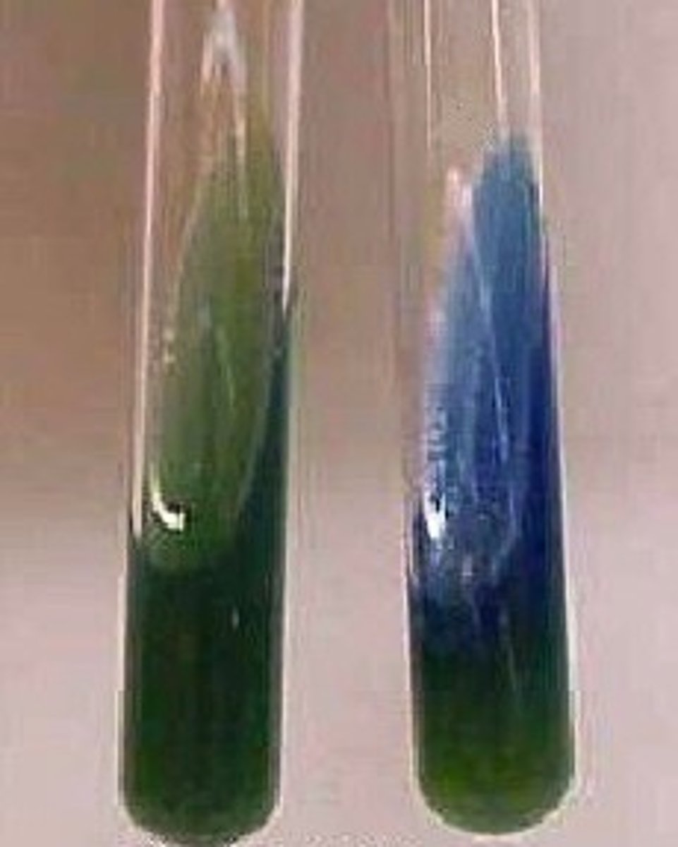 <p>CITRATE UTILIZATION TEST</p><p>A blue color indicates . . .</p>