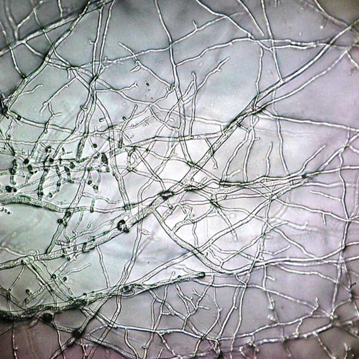 <p>mass of fungal hyphae</p>