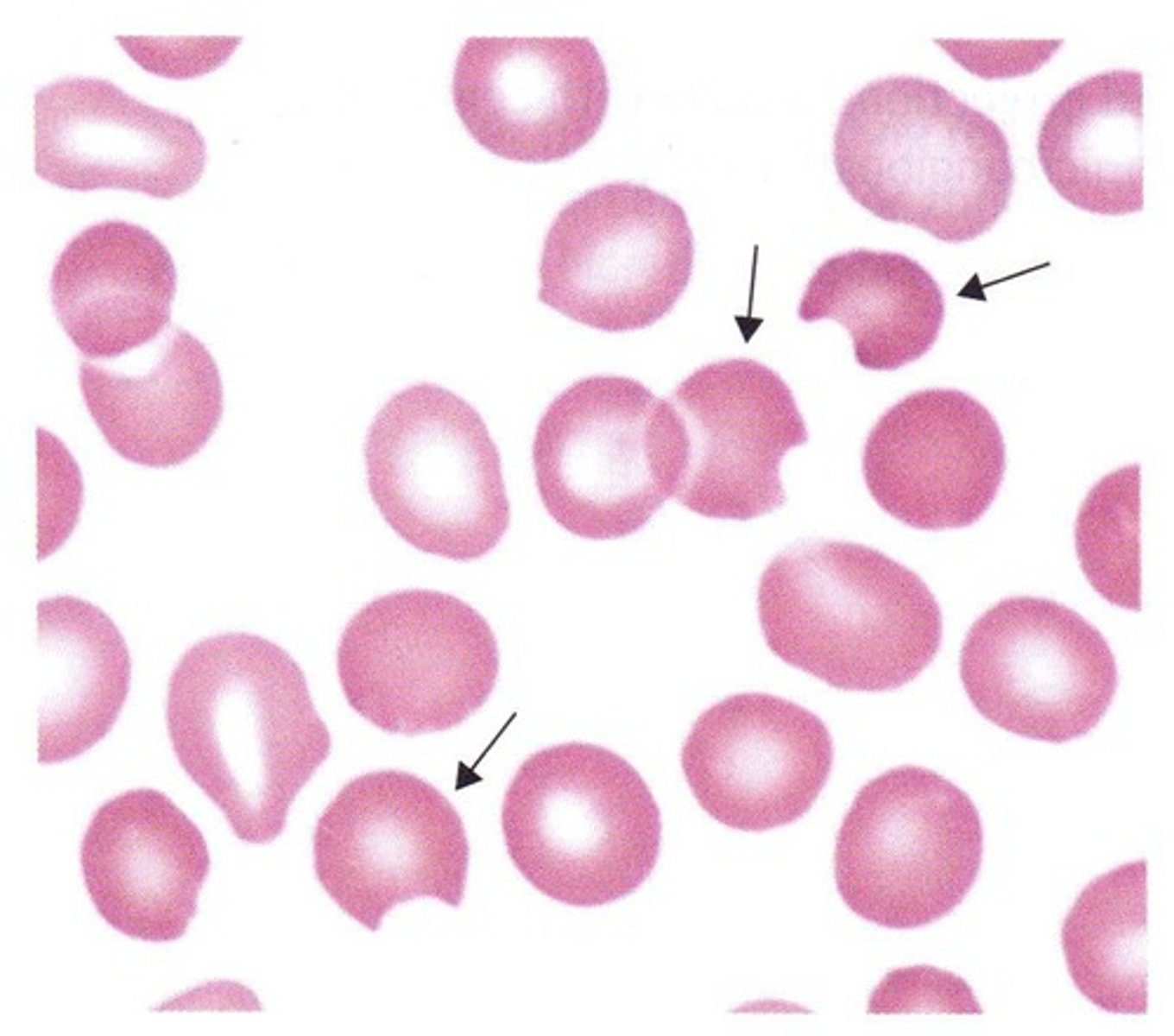 <p>splenic pitting - because macrophages take a bite out  </p>