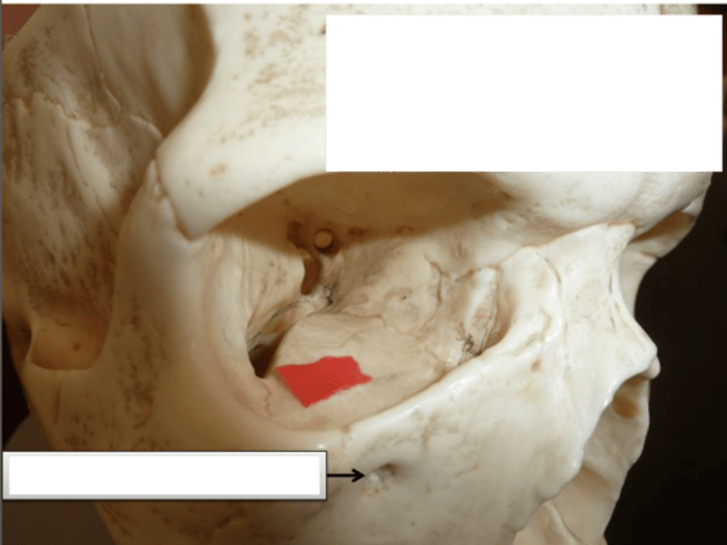 <p>identify bottom white rectangle</p>