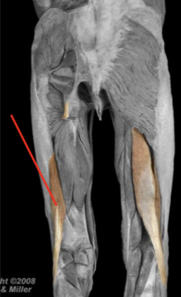 <p>Biceps femoris (short head)</p>