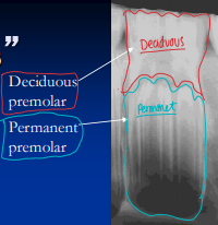 <p><span style="background-color: transparent;">Dental Disease</span></p>