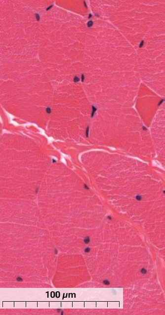 <p>What type of muscle are the dark muscle fibres and what are the light ones in this skeletal muscle?</p>