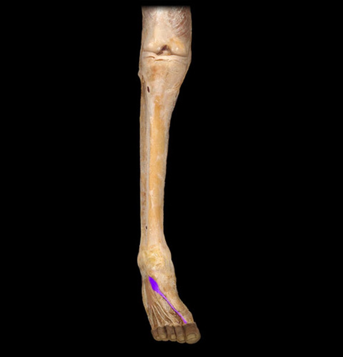 <p>Part of the extensor digitorum brevis, but appears separate and moves the big toe.</p>