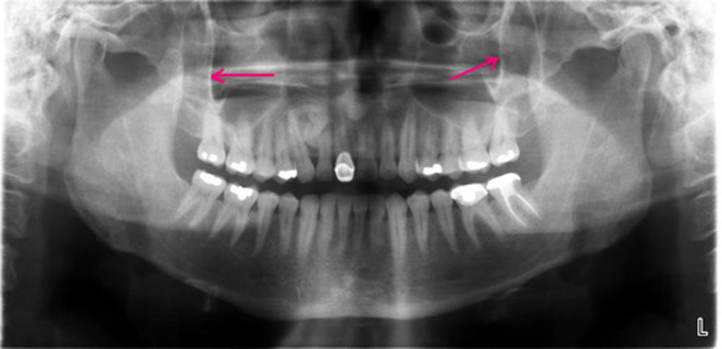 <p>Identify the structure.</p>