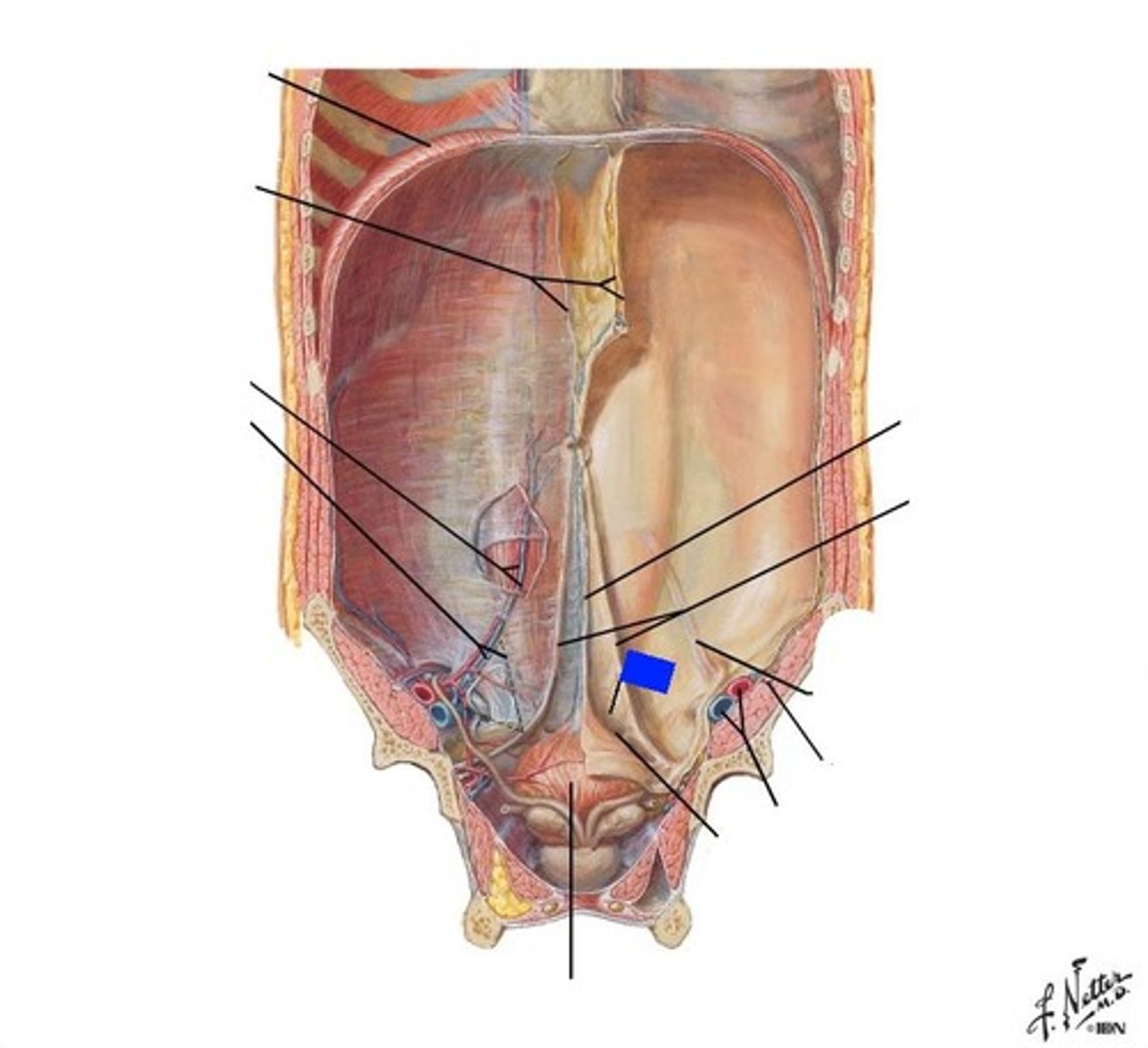 <p>between median and medial umbilical folds</p>