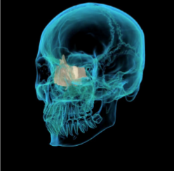 <p>Which cranial bone is this? (1)</p>