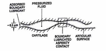 <p>The figure illustrates mixed lubrication of articular cartilage. The special protein adsorbed to the surface that lubricates at points of asperity contact is _____________.</p><p>a. WD-40</p><p>b. hyaluronic acid</p><p>c. lubricin</p><p>d. lubrizel</p>