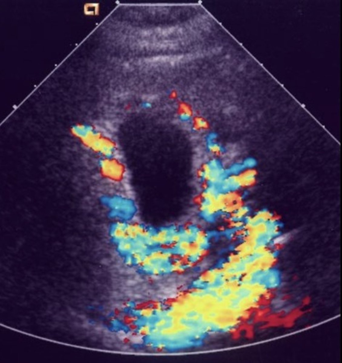 <p>Serpentine anechoic structures along GB wall</p>