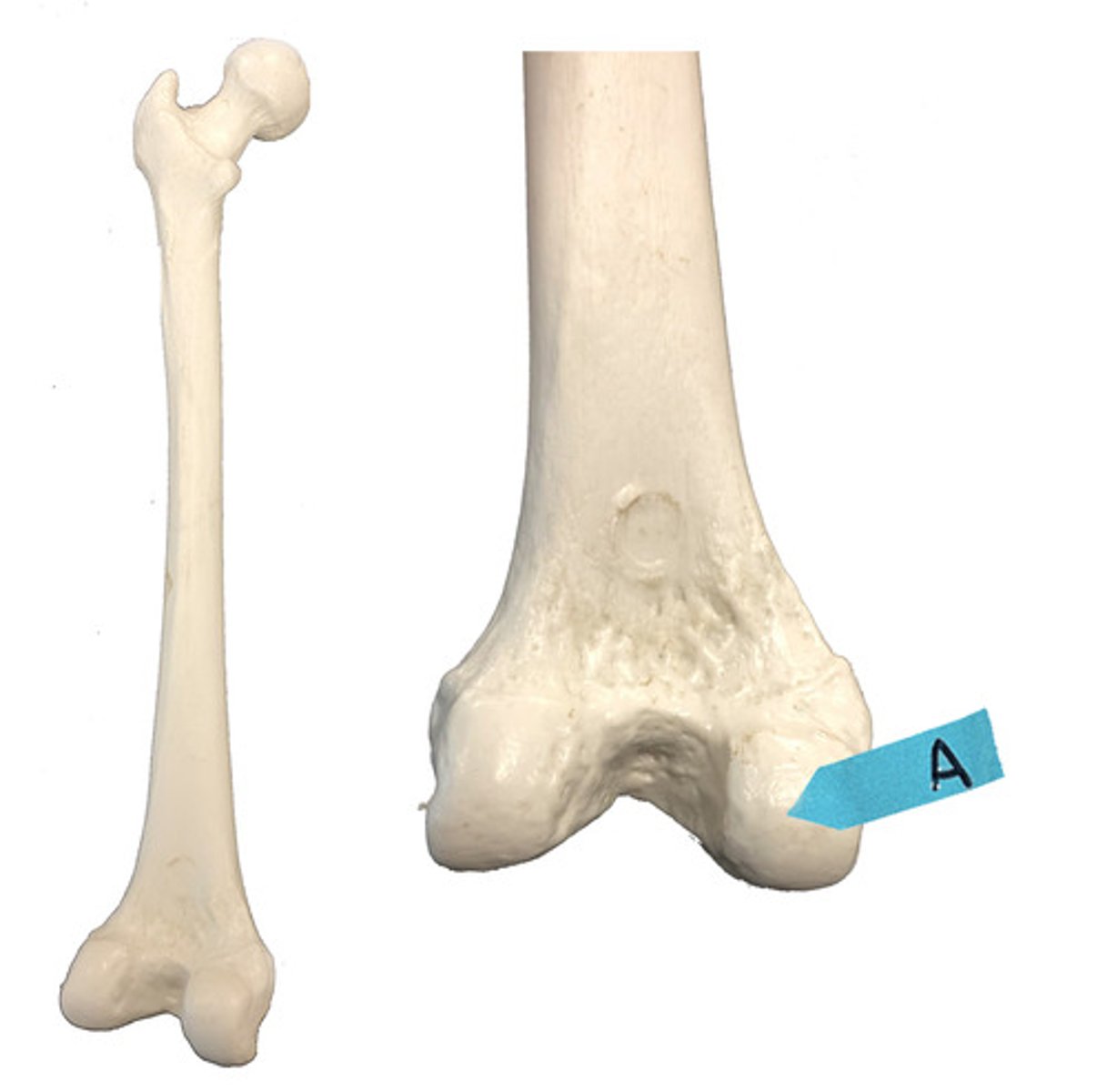 <p>Identify this bone marking.</p>