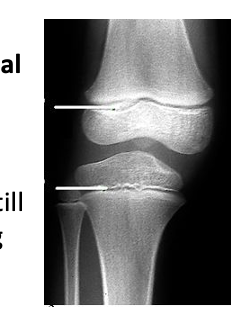 <p>contains cartilage; growth still occurring</p>