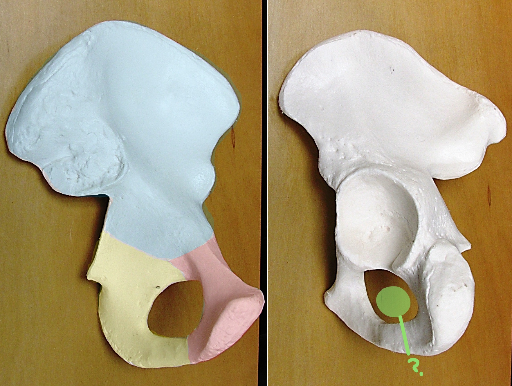 <p>Determine the part of the Coxa highlighted</p>